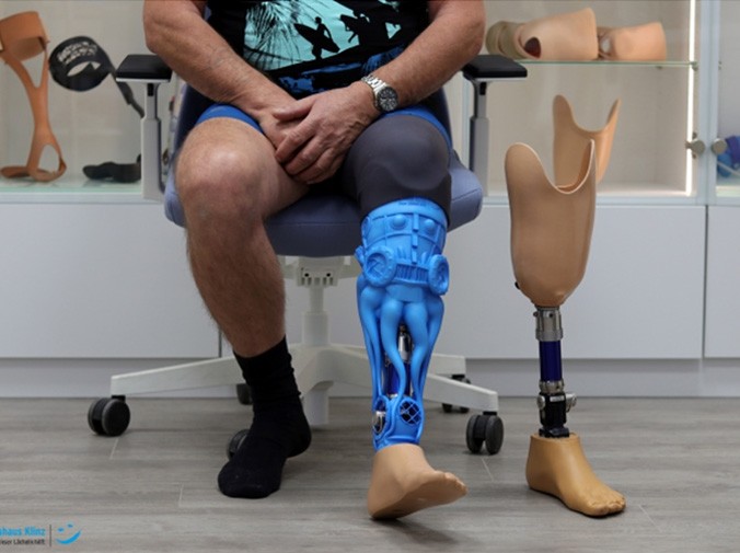 Artec Eva与Geomagic Freeform共同担纲，定制独一无二的假肢